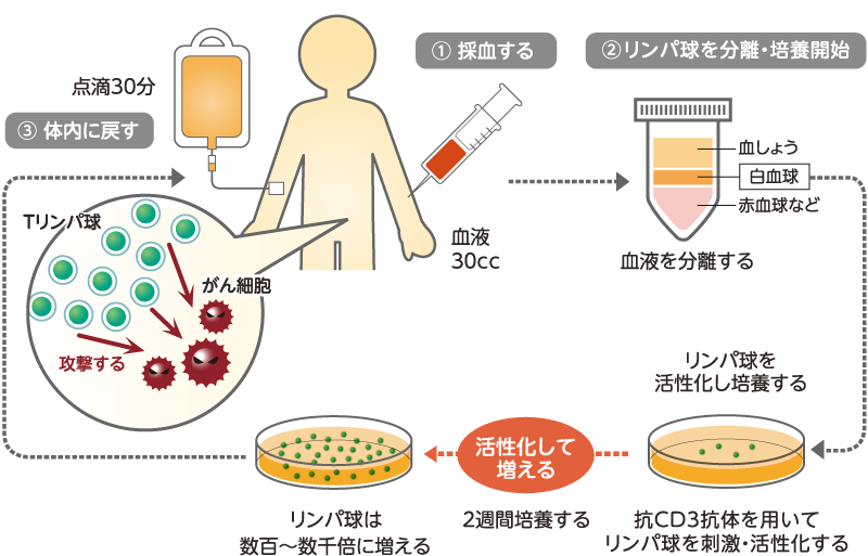 CD3 活性化(αβ)T 細胞療法(CAT 療法)